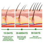 Rosemary Hair Growth Essential Oil — 100% Pure, Strengthens & Thickens Hair